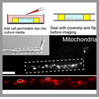 A low-cost 3D cell culture system for imaging neurons